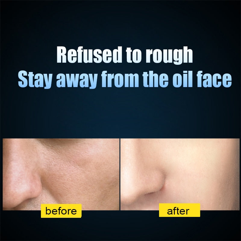 Men skin care set Face Cream eye cream Serum Skin Care Whitening Acne Treatment Moisturizing Face Care  Repair Oil Control 5pcs | TageUnlimited